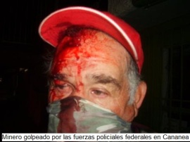 Minero golpeado por policías federales